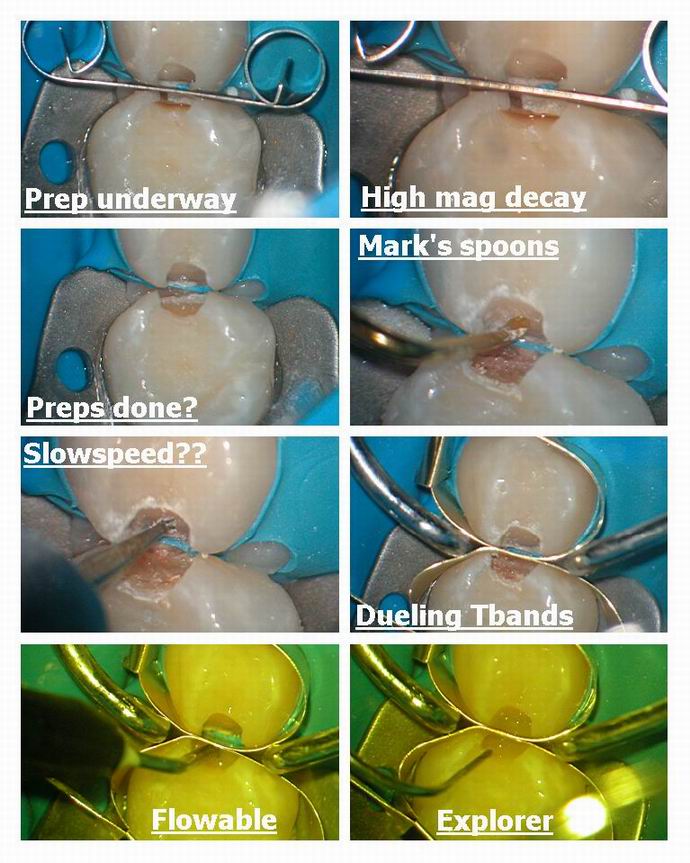 Resize of Class 2s without anesthetic pg 2.jpg